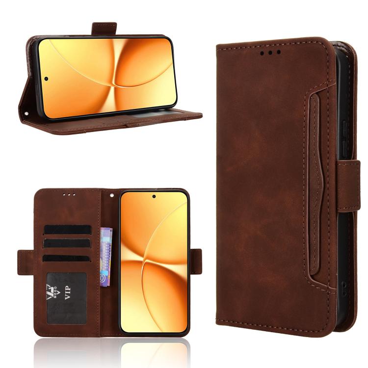 Skin Feel Calf Texture Card Slots Leather Phone Case, For Redmi 17C 4G / 14C 4G / 14R / A4, For Redmi A7 Pro 171mm / Poco C85x 5G, For Redmi 15a 5G / R70 5G / R70m 5G, For Redmi Turbo 5 Max 5G / Poco X8 Pro Max