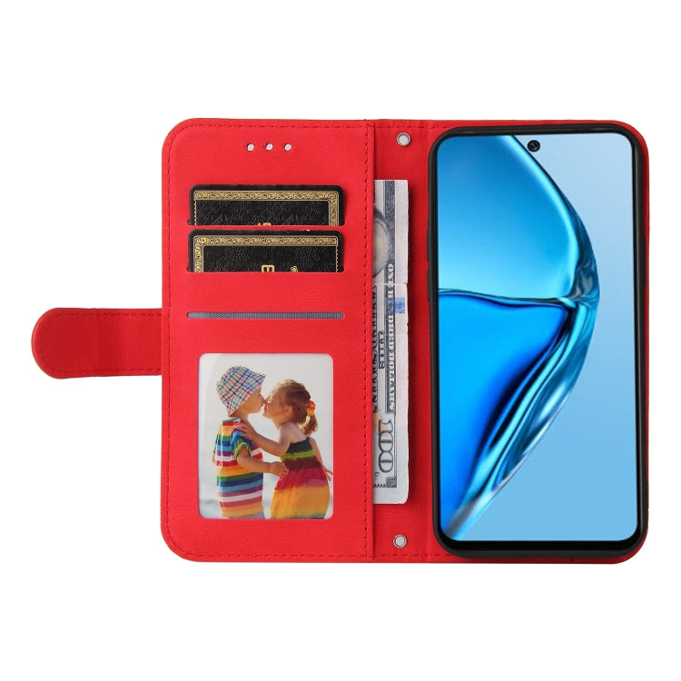 Skin Feel Life Tree Metal Button Leather Phone Case, For Infinix Hot 20 4G, For Infinix Hot 20s, For Infinix Note 12 / G96