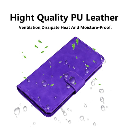 Skin Feel Pure Color Flip Leather Phone Case