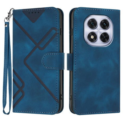 Line Pattern Skin Feel Leather Phone Case, For Redmi Note 14 5G, For Redmi Note 14 Pro+ 5G, For Redmi Note 14 Pro 5G, For Redmi 13 4G