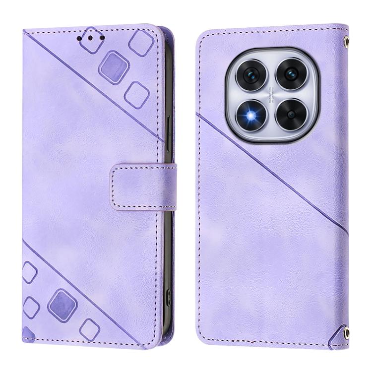 Skin-feel Embossed Leather Phone Case, For Redmi Note 14 Pro 4G, For Redmi Note 14 4G 163.25mm, For Redmi Note 14 5G Global, For Redmi Note 14 Pro 5G Global