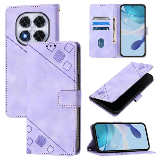 Skin-feel Embossed Leather Phone Case, For Redmi Note 14 Pro 4G, For Redmi Note 14 4G 163.25mm, For Redmi Note 14 5G Global, For Redmi Note 14 Pro 5G Global