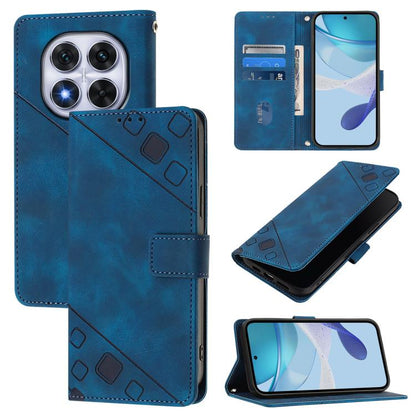 Skin-feel Embossed Leather Phone Case, For Redmi Note 14 Pro 4G, For Redmi Note 14 4G 163.25mm, For Redmi Note 14 5G Global, For Redmi Note 14 Pro 5G Global