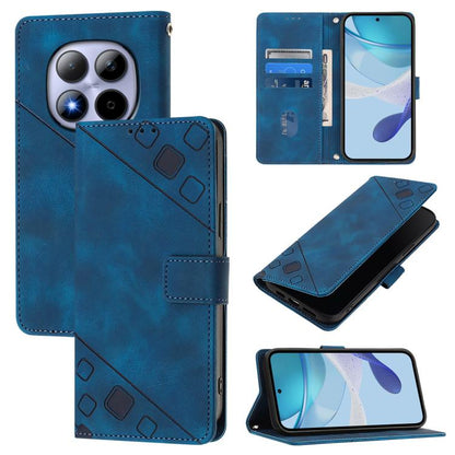 Skin-feel Embossed Leather Phone Case, For Redmi Note 15 Pro 5G Global 163.6mm, For Redmi 15 5G Global / 15 4G SEA, For Redmi 15 5G / 4G EU 171mm, For Redmi Note 14 4G 164.84mm