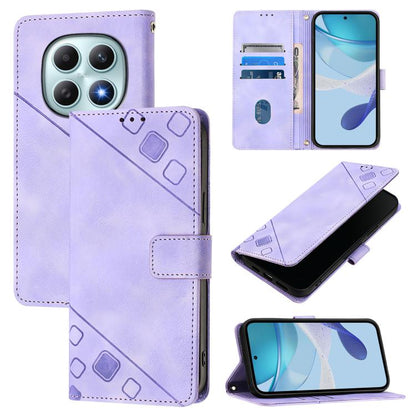 Skin-feel Embossed Leather Phone Case, For Redmi 15a 5G Global, For Redmi Turbo 5 5G Global / Poco X8 Pro, For Redmi Note 15 Pro+ 5G Global 163.3mm, For Redmi Note 15 4G / 5G Global 164mm