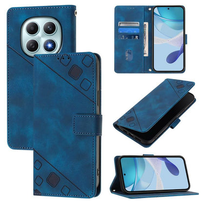 Skin-feel Embossed Leather Phone Case, For Redmi Turbo 5 5G Global / Poco X8 Pro, For Redmi Note 15 Pro+ 5G Global 163.3mm, For Redmi Note 15 4G / 5G Global 164mm, For Redmi Note 15 Pro 5G Global 163.6mm