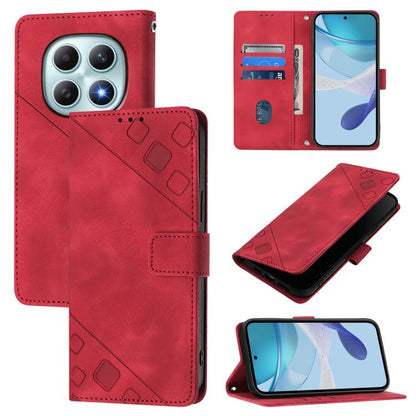 Skin-feel Embossed Leather Phone Case, For Redmi Turbo 5 5G Global / Poco X8 Pro, For Redmi Note 15 Pro+ 5G Global 163.3mm, For Redmi Note 15 4G / 5G Global 164mm, For Redmi Note 15 Pro 5G Global 163.6mm