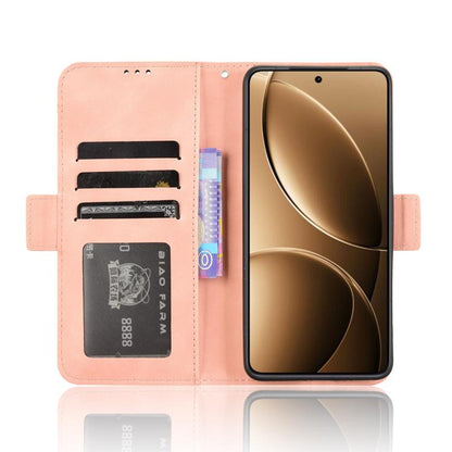 Skin Feel Calf Texture Card Slots Leather Phone Case, For Redmi K80 / K80 Pro, For Redmi Note 14 Pro 4G, For Redmi Note 14 4G Global 163.25mm, For Redmi Note 14 Pro+ 5G