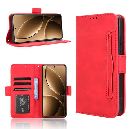 Skin Feel Calf Texture Card Slots Leather Phone Case, For Redmi A5 4G 173.3mm, For Redmi Note 14 4G 164.84mm EU Version, For Redmi Turbo 4 Pro 5G, For Redmi K80 / K80 Pro