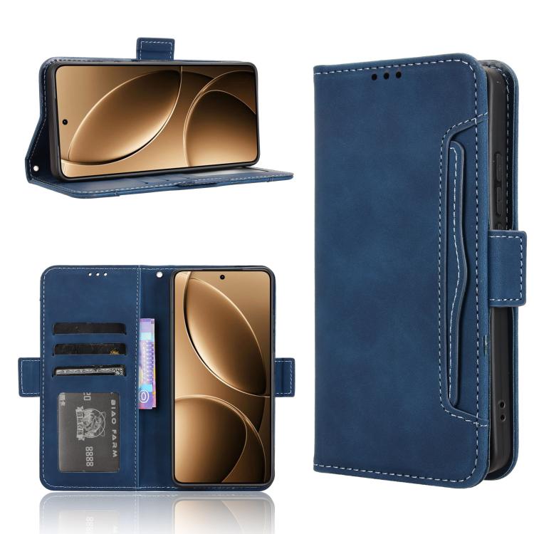 Skin Feel Calf Texture Card Slots Leather Phone Case, For Redmi A5 4G 173.3mm, For Redmi Note 14 4G 164.84mm EU Version, For Redmi Turbo 4 Pro 5G, For Redmi K80 / K80 Pro