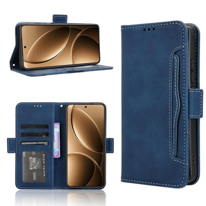 Skin Feel Calf Texture Card Slots Leather Phone Case, For Redmi A5 4G 173.3mm, For Redmi Note 14 4G 164.84mm EU Version, For Redmi Turbo 4 Pro 5G, For Redmi K80 / K80 Pro
