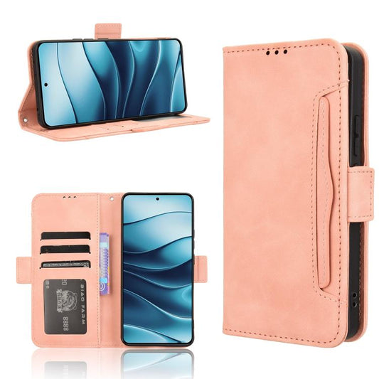Skin Feel Calf Texture Card Slots Leather Phone Case, For Redmi Note 14 4G Global 163.25mm, For Redmi Note 14 Pro+ 5G, For Redmi 14C 4G, For Redmi K70 Ultra