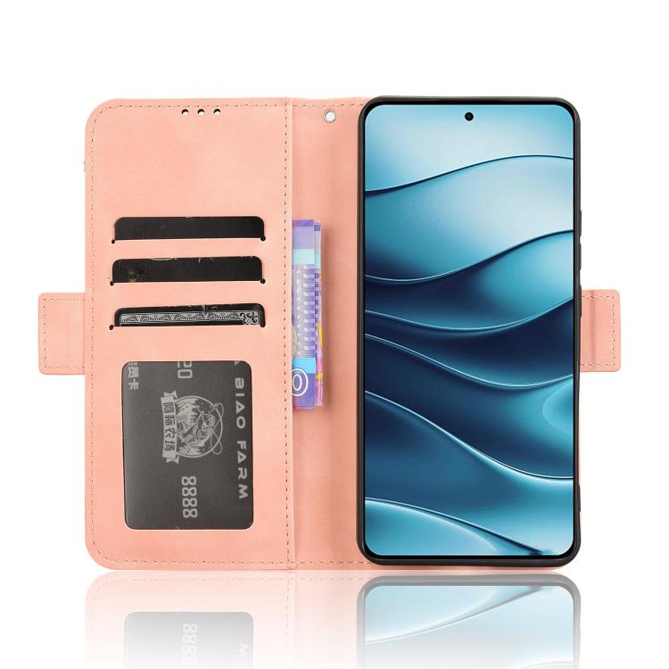 Skin Feel Calf Texture Card Slots Leather Phone Case, For Redmi Note 14 4G Global 163.25mm, For Redmi Note 14 Pro+ 5G, For Redmi 14C 4G, For Redmi K70 Ultra