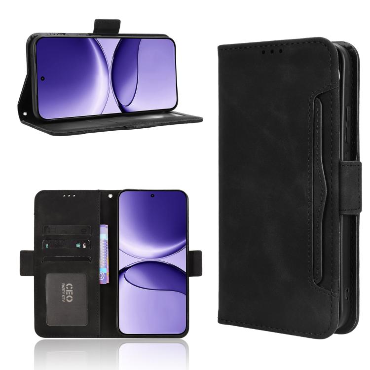 Skin Feel Calf Texture Card Slots Leather Phone Case, For Redmi A5 4G 173.3mm, For Redmi Note 14 4G 164.84mm EU Version, For Redmi Turbo 4 Pro 5G, For Redmi K80 / K80 Pro