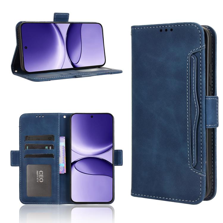 Skin Feel Calf Texture Card Slots Leather Phone Case, For Redmi A5 4G 173.3mm, For Redmi Note 14 4G 164.84mm EU Version, For Redmi Turbo 4 Pro 5G, For Redmi K80 / K80 Pro