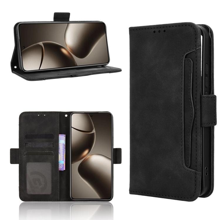 Skin Feel Calf Texture Card Slots Leather Phone Case, For Redmi 15C 5G / 4G Global 171mm / Poco C85 4G, For Xiaomi 15T Pro 5G, For Xiaomi 15T 5G, For Redmi K80 Ultra