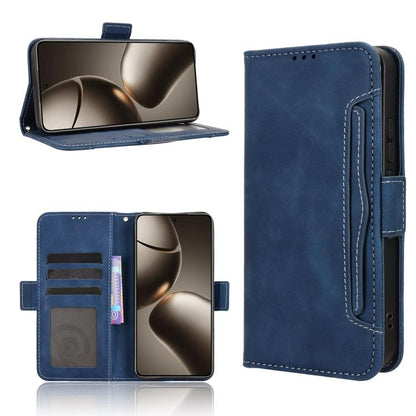 Skin Feel Calf Texture Card Slots Leather Phone Case, For Redmi 15C 5G / 4G Global 171mm / Poco C85 4G, For Xiaomi 15T Pro 5G, For Xiaomi 15T 5G, For Redmi K80 Ultra