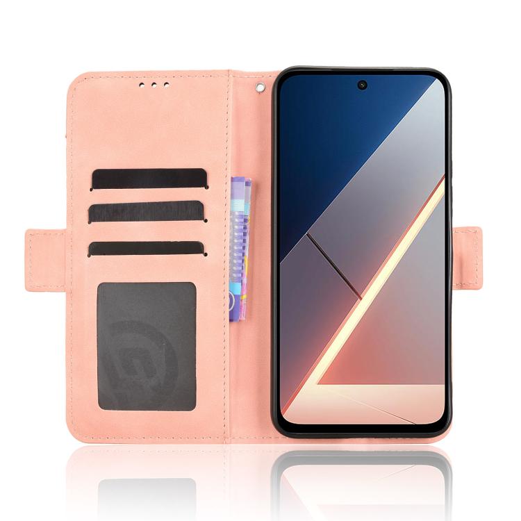 Skin Feel Calf Texture Card Slots Leather Phone Case, For Xiaomi Poco M7 4G 169mm, For Redmi 15 5G Global / 15 4G SEA 169.5mm, For Redmi 15 5G / 4G EU 171mm, For Redmi 15C 5G / 4G Global 171mm / Poco C85 4G