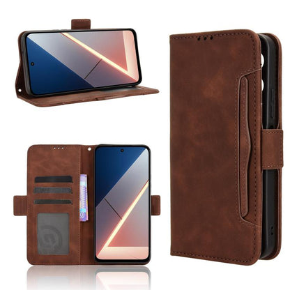 Skin Feel Calf Texture Card Slots Leather Phone Case, For Xiaomi 17, For Redmi 15C 5G / 4G EU 173mm / Poco C85 5G, For Xiaomi Poco M7 4G 169mm, For Redmi 15 5G Global / 15 4G SEA 169.5mm