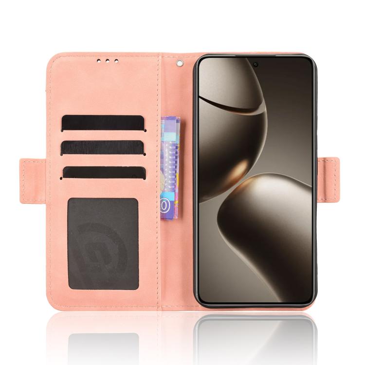 Skin Feel Calf Texture Card Slots Leather Phone Case, For Xiaomi 15T Pro 5G, For Xiaomi 15T 5G, For Redmi K80 Ultra, For Redmi A5 4G 173.3mm