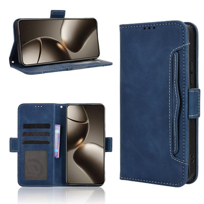 Skin Feel Calf Texture Card Slots Leather Phone Case, For Redmi 15C 5G / 4G Global 171mm / Poco C85 4G, For Xiaomi 15T Pro 5G, For Xiaomi 15T 5G, For Redmi K80 Ultra