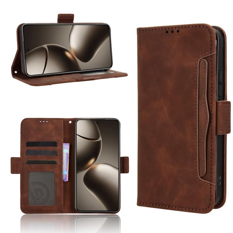 Skin Feel Calf Texture Card Slots Leather Phone Case, For Xiaomi 15T Pro 5G, For Xiaomi 15T 5G, For Redmi K80 Ultra, For Redmi A5 4G 173.3mm