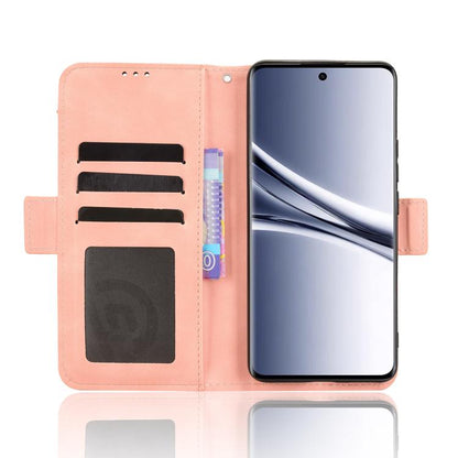 Skin Feel Calf Texture Card Slots Leather Phone Case, For Redmi Note 15 5G / 4G 164mm / Poco M8 5G, For Redmi K90 Pro Max 5G / Poco F8 Ultra, For Redmi Note 15 Pro 4G Global 163.2mm, For Redmi K90 5G / Poco F8 Pro