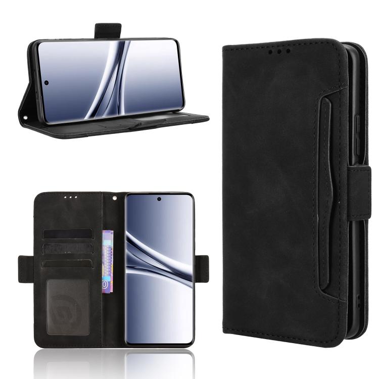 Skin Feel Calf Texture Card Slots Leather Phone Case, For Redmi Turbo 5 5G / Poco X8 Pro, For Redmi Note 15 Pro+ 5G 163.3mm/Poco M8 Pro 5G, For Redmi Note 15 5G / 4G 164mm / Poco M8 5G, For Redmi K90 Pro Max 5G / Poco F8 Ultra