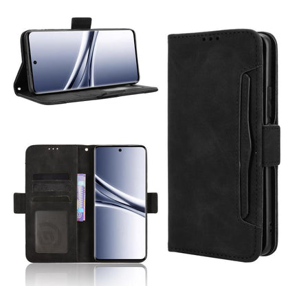 Skin Feel Calf Texture Card Slots Leather Phone Case, For Redmi Turbo 5 5G / Poco X8 Pro, For Redmi Note 15 Pro+ 5G 163.3mm/Poco M8 Pro 5G, For Redmi Note 15 5G / 4G 164mm / Poco M8 5G, For Redmi K90 Pro Max 5G / Poco F8 Ultra