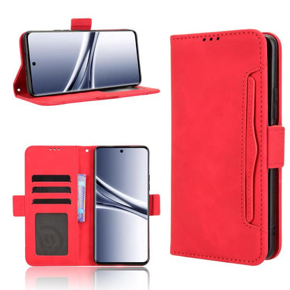 Skin Feel Calf Texture Card Slots Leather Phone Case, For Redmi Turbo 5 5G / Poco X8 Pro, For Redmi Note 15 Pro+ 5G 163.3mm/Poco M8 Pro 5G, For Redmi Note 15 5G / 4G 164mm / Poco M8 5G, For Redmi K90 Pro Max 5G / Poco F8 Ultra