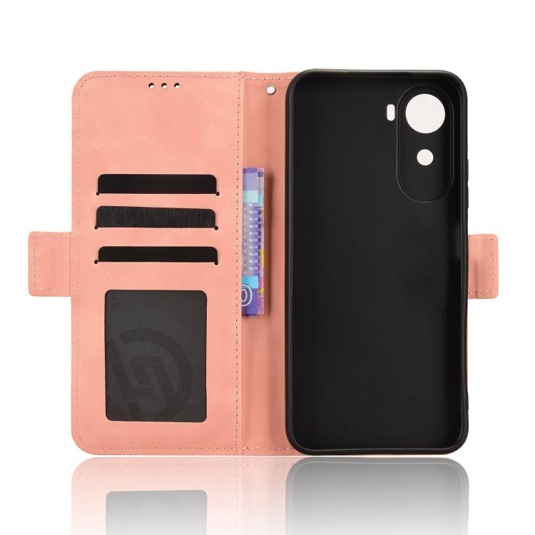 Skin Feel Calf Texture Card Slots Leather Phone Case, For Redmi A7 Pro 171mm / Poco C85x 5G, For Redmi Turbo 5 Max 5G / Poco X8 Pro Max, For Redmi Turbo 5 5G / Poco X8 Pro, For Redmi Note 15 Pro+ 5G 163.3mm/Poco M8 Pro 5G