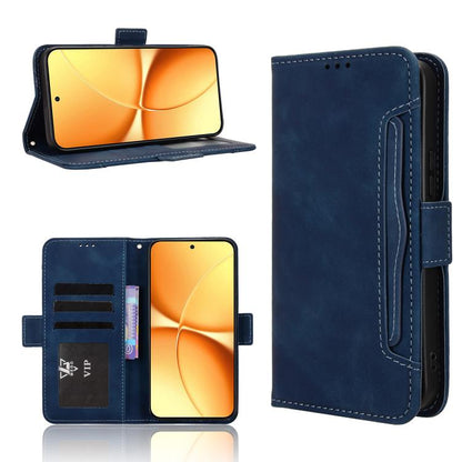 Skin Feel Calf Texture Card Slots Leather Phone Case, For Redmi A7 Pro 171mm / Poco C85x 5G, For Redmi Turbo 5 Max 5G / Poco X8 Pro Max, For Redmi Turbo 5 5G / Poco X8 Pro, For Redmi Note 15 Pro+ 5G 163.3mm/Poco M8 Pro 5G