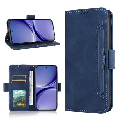 Skin Feel Calf Texture Card Slots Leather Phone Case, For Redmi Turbo 5 5G / Poco X8 Pro, For Redmi Note 15 Pro+ 5G 163.3mm/Poco M8 Pro 5G, For Redmi Note 15 5G / 4G 164mm / Poco M8 5G, For Redmi K90 Pro Max 5G / Poco F8 Ultra