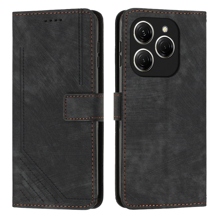 Skin Feel Stripe Pattern Leather Phone Case